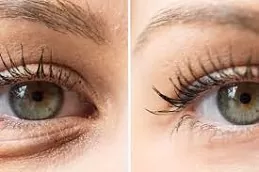 رفع بلكسر بلازما للعين دبي