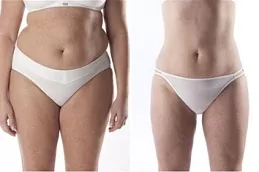 شفط الدهون من الجسم النفاث دبي