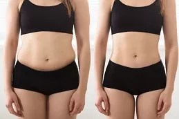 شفط الدهون من الجسم في دبي