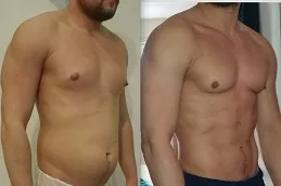 نحت الجسم عالي الدقة في أبو ظبي