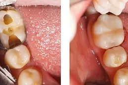 أفضل حشو أسنان في أبوظبي