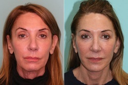 أفضل عيادة تجميل غير جراحية في دبي