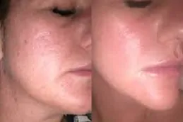 أفضل عيادة علاج الديرمابين في دبي