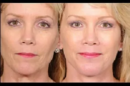 شد ذيل الحصان في دبي