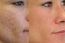 عيادة علاج الديرمابين في دبي