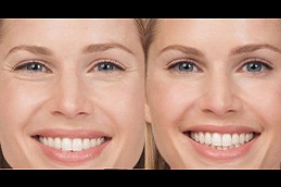 أفضل تنعيم للتجاعيد في أبو ظبي