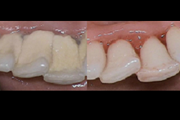 أفضل شركة تنظيف أسنان في دبي