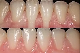 تركز عامل النمو cgf في دبي