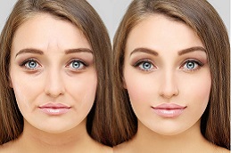 تنعيم التجاعيد في أبو ظبي