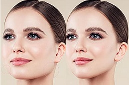 عيادة تنعيم التجاعيد في دبي