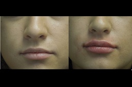 عيادة نحت الوجه في دبي