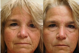 نحت الوجه في أبوظبي