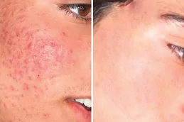 أفضل أمراض الجلد دبي