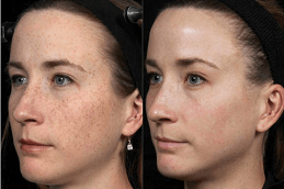 أفضل العلاج بالخلايا الجذعية دبي