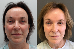 أفضل عيادة العلاج بالخلايا الجذعية في دبي