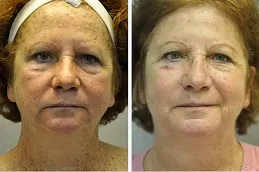 أفضل عيادة علاج التقران المثي دبي