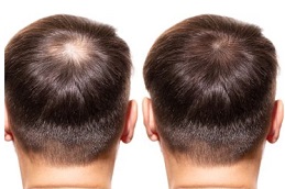 أفضل عيادة علاج ريجينيرا أكتيفا في دبي