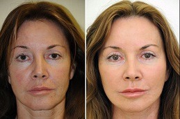 الطب التجديدي في دبي