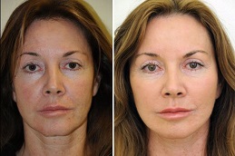 العلاج بالخلايا الجذعية في دبي