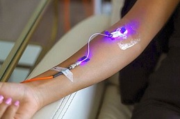 أفضل العلاج بالليزر المنخفض الرابع في دبي