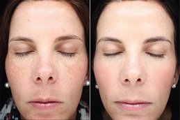 أفضل عيادة علاج هالو دبي