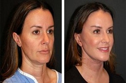 شد الوجه السحري في دبي