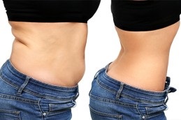 عملية شد البطن المحيطية في دبي