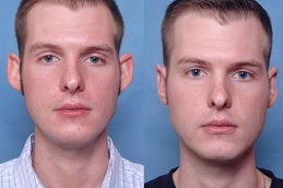 جراحة الأذن