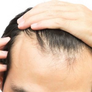 4000 و 5000 زراعة الشعر بصيلة في دبي