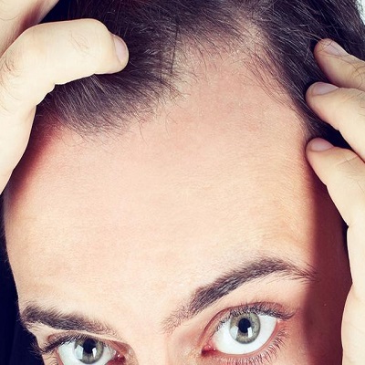تكلفة زراعة الشعر فوت في دبي وأبو ظبي الأسعار والصفقات