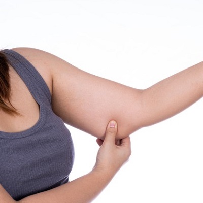 تكلفة شفط دهون الذراع في دبي وأبو ظبي والشارقة سعر Arm Lipo