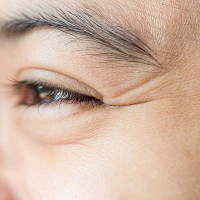 علاج تنعيم التجاعيد في دبي وأبو ظبي والشارقة التكلفة والصفقات