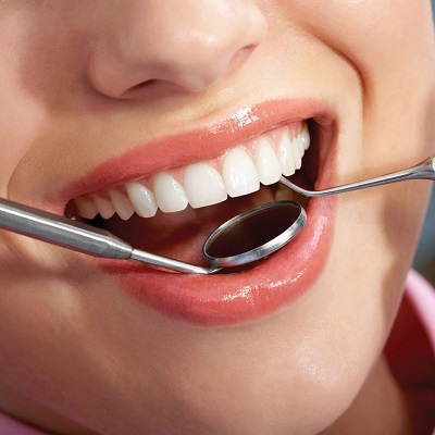 تبييض الاسنان وتقشيرها في دبي وأبو ظبي تكلفة تلميع الأسنان