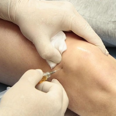 حقن البلازما الغنية بالصفائح الدموية (PRP) لتمزق الأربطة في دبي وأبو ظبي والشارقة كلفة