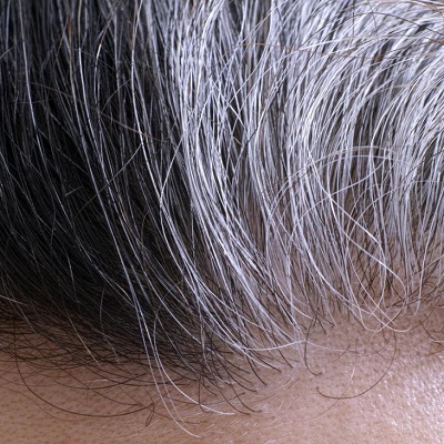 زراعة الشعر للشعر الرمادي في دبي وأبو ظبي سعر الكلفة