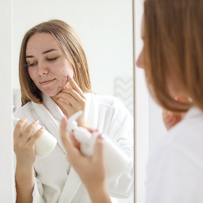 علاج ندبات حب الشباب للبشرة الحساسة