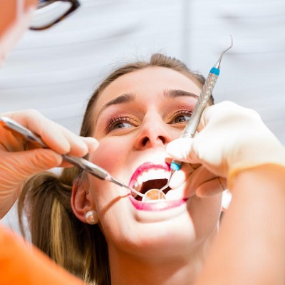 أفضل شركة تنظيف أسنان في دبي وأبو ظبي تكلفة تنظيف الأسنان