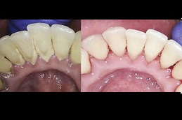 طب الاسنان - حساب التفاضل والتكامل في ابوظبي