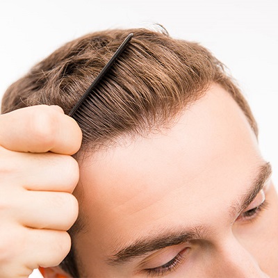 هل دبي جيدة لزراعة الشعر رويال كلينيك الامارات