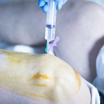 العلاج بالخلايا الجذعية للركبة دبي وأبو ظبي