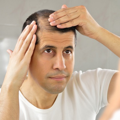 هل يعمل PRP على إعادة نمو الشعر بنسبة مئوية في دبي