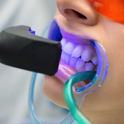 ما يجب فعله وما لا يجب فعله بعد تبييض الأسنان في دبي وأبو ظبي سعر