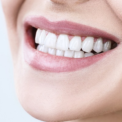 كيف تختار أفضل عيادة لابتسامة هوليوود في دبي وأبو ظبي يكلف
