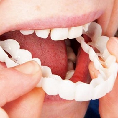 ما هو الوقت المناسب لعمل قشرة الأسنان في دبي؟