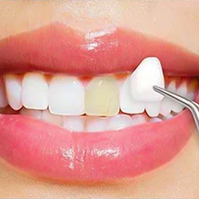 القشرة تجعلك أكثر جاذبية في دبي وأبو ظبي والشارقة يكلف