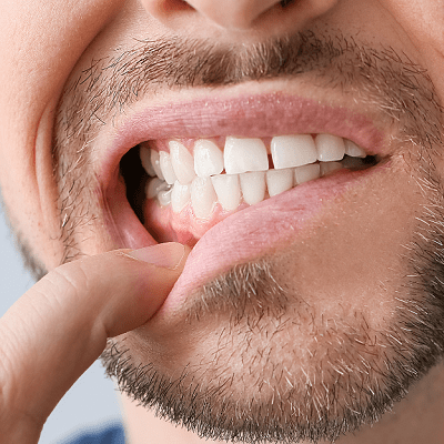 هل تبييض الأسنان مؤلم في دبي وأبو ظبي والإمارات العربية المتحدة