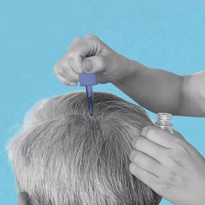 علاج تساقط الشعر وتساقط الشعر بتقنية PRP في دبي