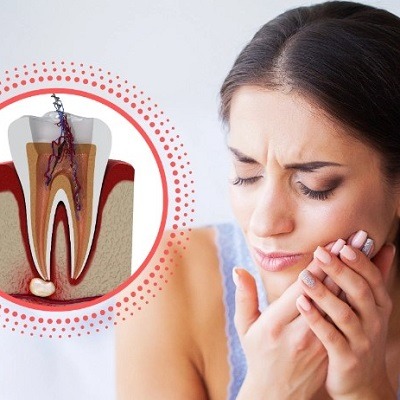 ما مقدار الألم الذي سأعانيه بعد إجراء معالجة قناة الجذر في دبي