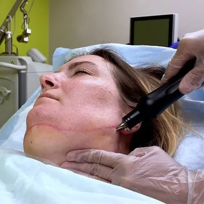كيفية التخلص من إزالة الذقن المزدوجة في دبي وأبو ظبي