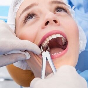 هل الأسنان أسهل في الإزالة؟